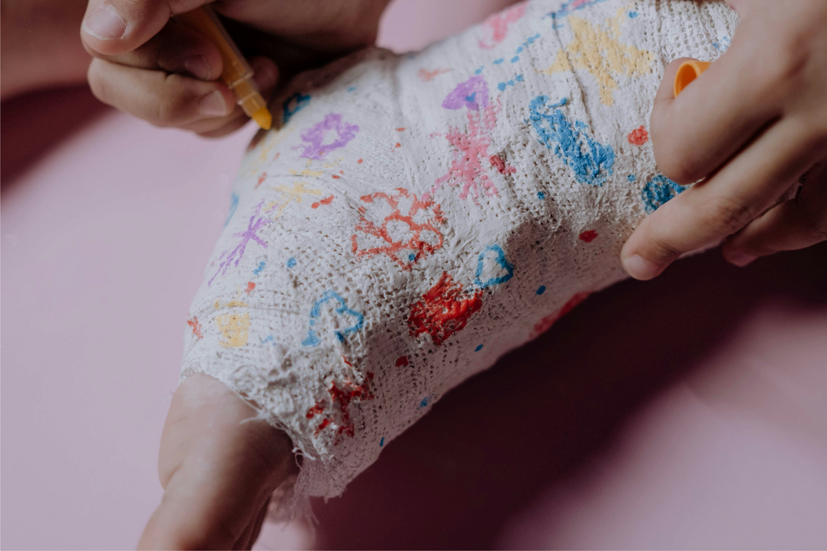 Break a Leg Dealing with broken bones in children