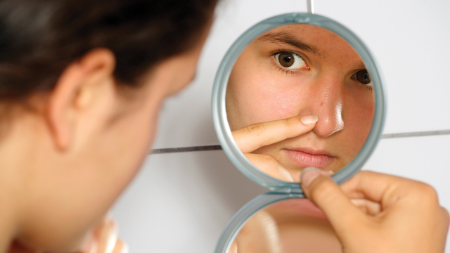 The Familiar Face of Teen Acne