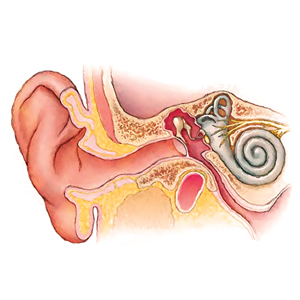 Winter-Proofing Ears