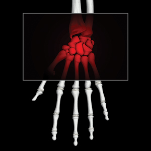 Oh, The Nerve!
Diagnosis