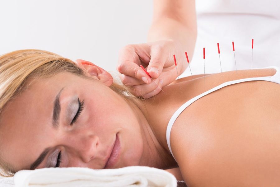 Why Acupuncture Might Be Right for You
